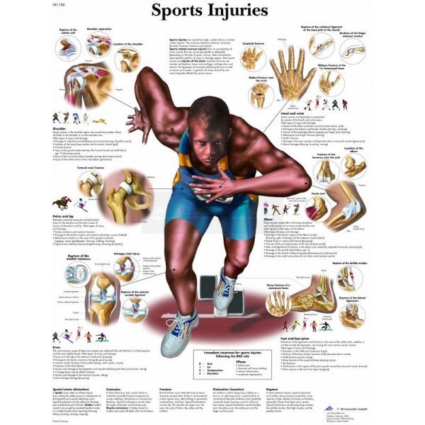 Ingelijste poster Sports Injuries - sportblessures 50,5 cm x 67,5 cm